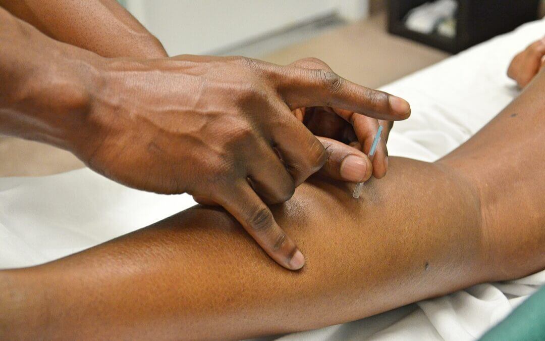 Acupuncture at Lyn-Lake Psychotherapy and Wellness